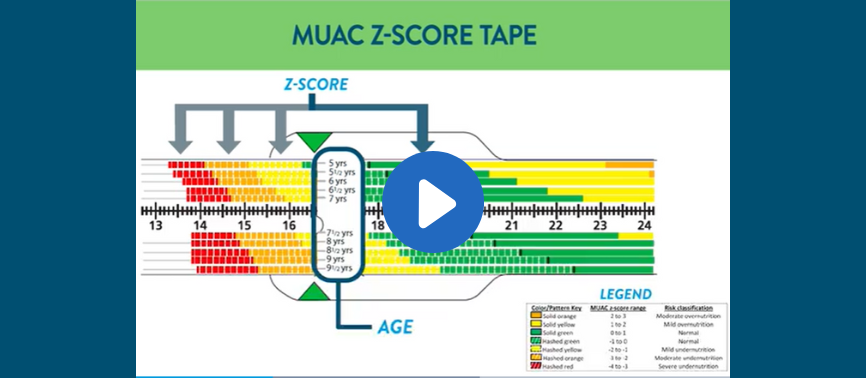 Mid Upper Arm Circumference MUAC Measurement   Measuring Mid Upper Arm Circumference In Pediatric Patients%2C Video 866x378 Tcm1423 165368 